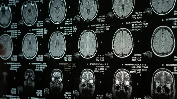  Images of brain scans 