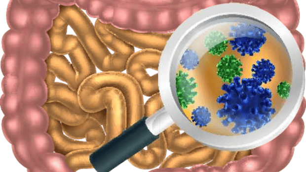  leaky gut, how and why it occurs 