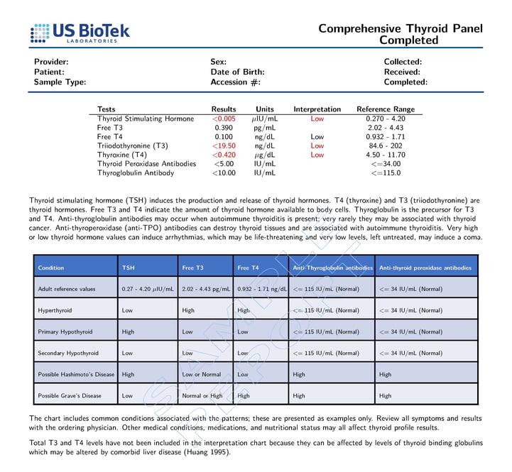 Comprehensive Thyroid Panel - Sample Report