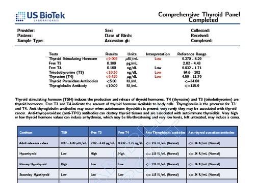 Comprehensive Thyroid Panel